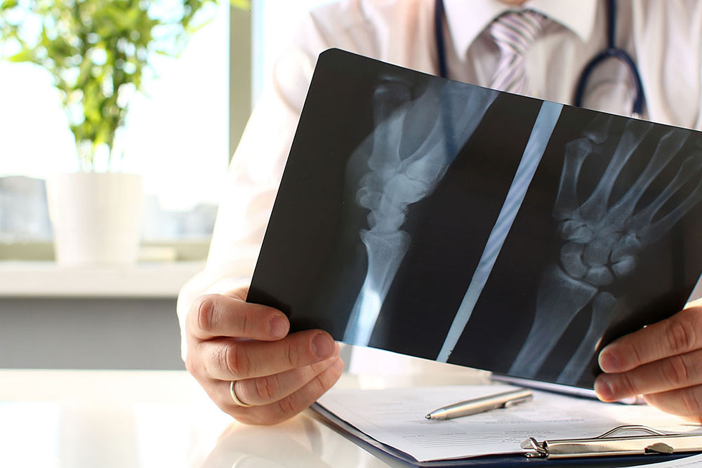 Medizinische Ausrüstung - X-Ray